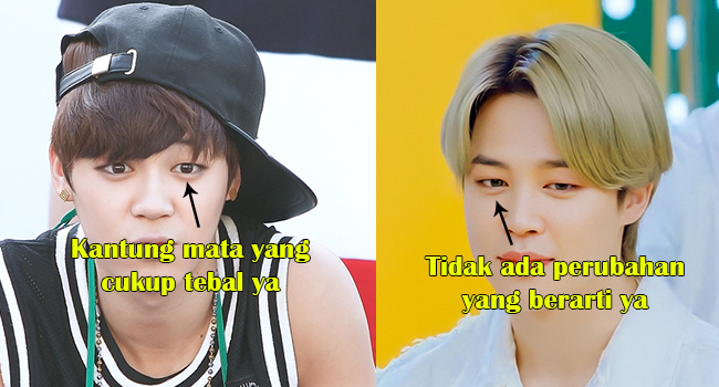 Apakah Mata Jimin Oplas? Lihat Perbandingan Wajahnya di sini - Fakta.id